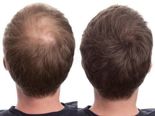 Caboki Hair Building Fibers